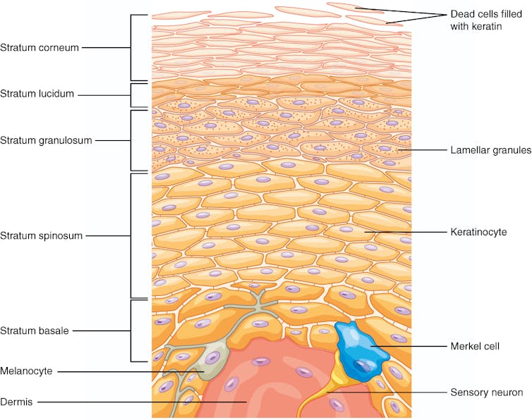 Diagram of five layers of epidermis, with the dermis at the bottom